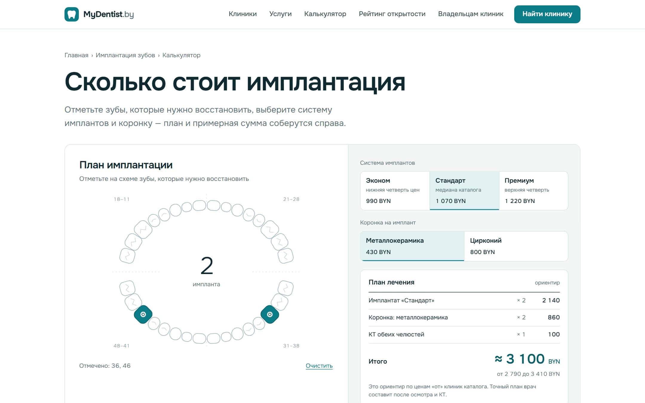 Калькулятор имплантации — mydentist.by